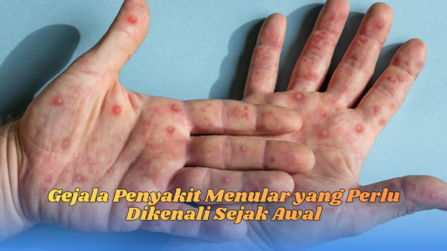 gejala penyakit menular