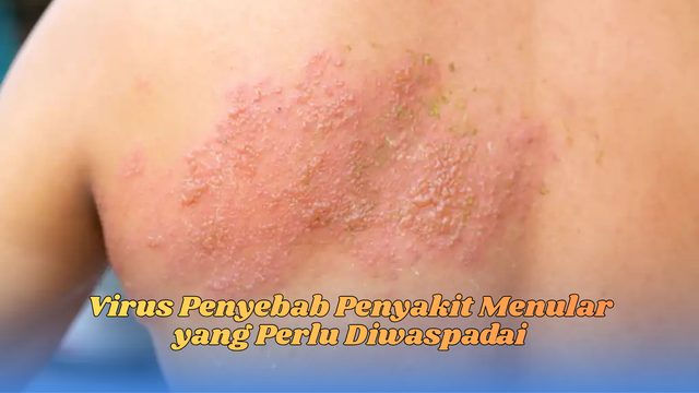 Virus Penyebab Penyakit Menular