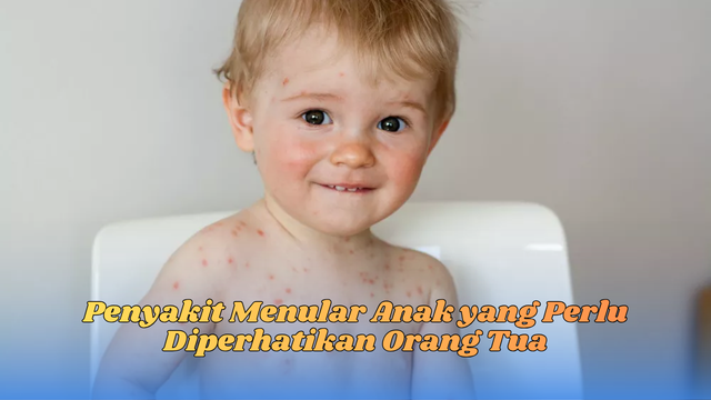 penyakit menular anak